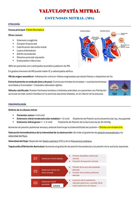 Valvulopat A Mitral Valvulopat A Mitral Estenosis Mitral Ms