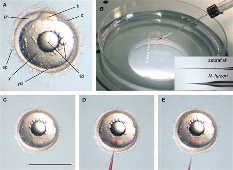 Zebrafish Embryo Injection