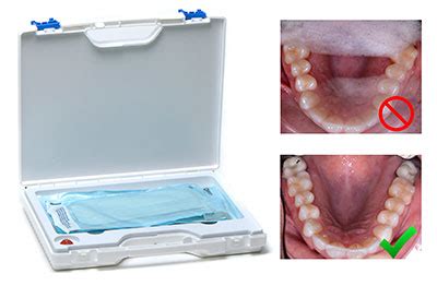 Photomed Intraoral Mirrors