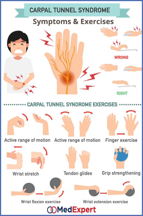 Carpal Tunnel Exercises Poster