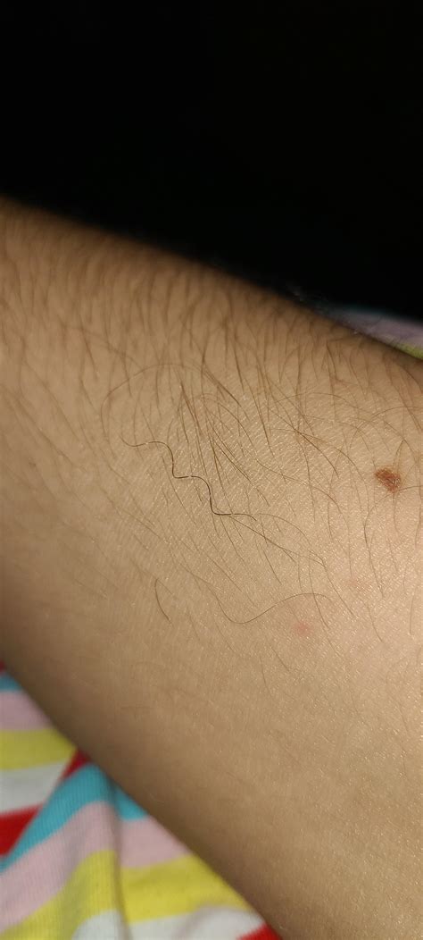 This curly hair on my arm : r/mildlyinteresting