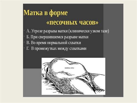 Разрыв матки - online presentation