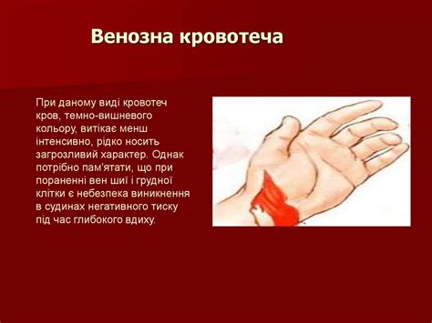 Кровотечі, їх класифікація. Перша допомога при кровотечах - презентация ...