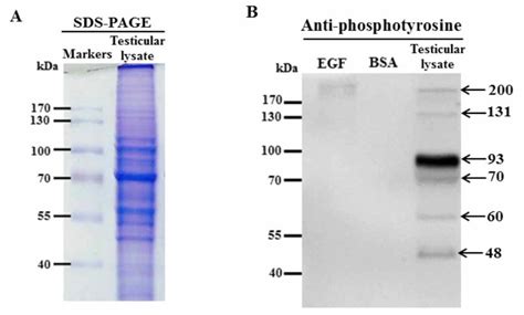 Representative Sds Page Stained By Coomassie Blue Showing Total