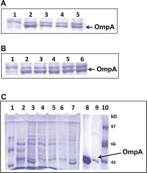 Immune Response Of S Typhi Derived Vi Polysaccharide And Outer