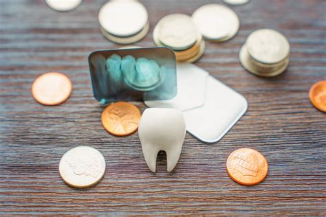 How Much Does A Root Canal Treatment Cost A Simple Guide