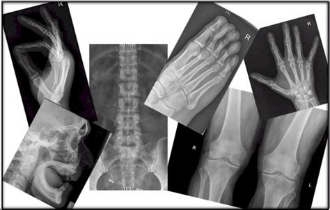 SWSLHD - Medical Imaging - Services - X-ray