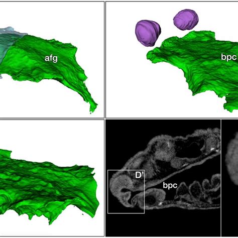 X Ray Micro Computed Tomography Microct Analysis Reveals Independent