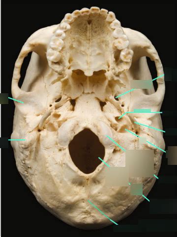 bio lab test 1 REAL skull inferior view of the skull Diagram | Quizlet