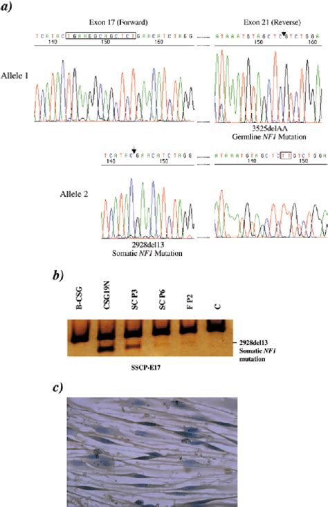 Figure From Schwann Cells Harbor The Somatic Nf Mutation In