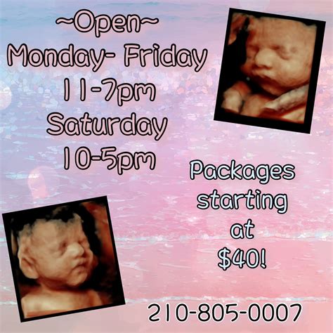 First Glimpse Imaging, a 3D 4D Prenatal Ultrasound Studio - 3D/4D