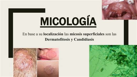 Micosis Y Pseudomicosis Ppt