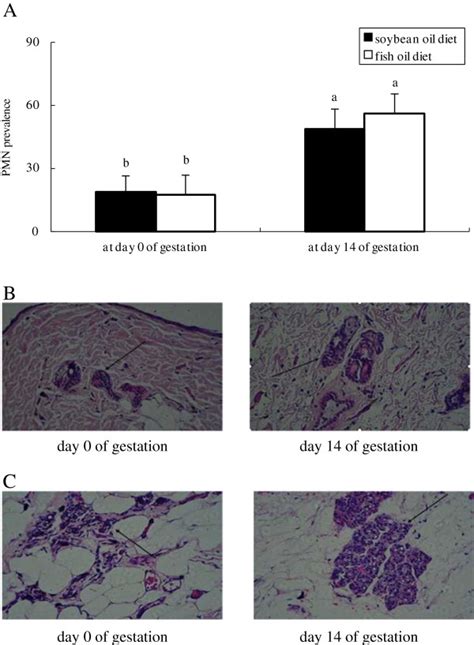 Histopathology Of Mammary Glands Of Rats Fed Different Diets At