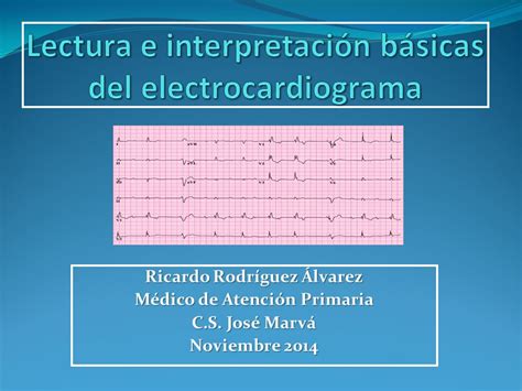 Lectura e interpretación básicas del electrocardiograma ppt video