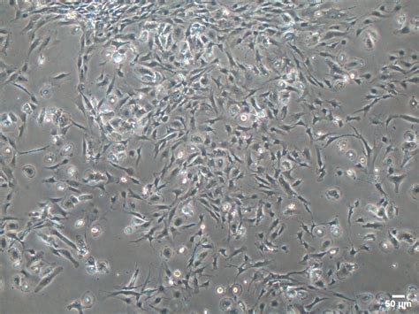 Human Hepatic Stellate Cells Becytes Biotechnologies