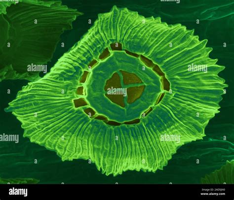 Spanish Moss Leaf Trichome Tillandsia Usneoides Coloured Scanning