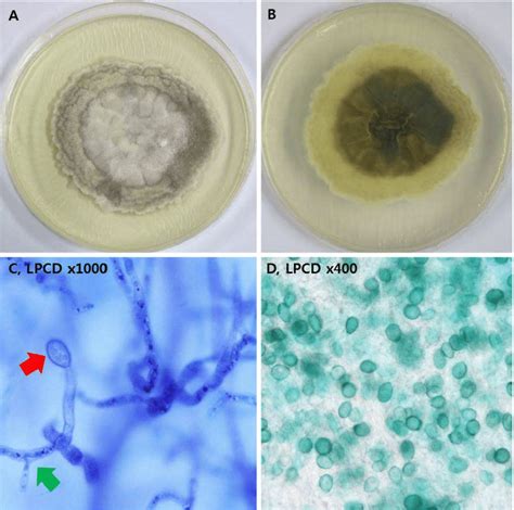 A The Colony On Sabourauds Dextrose Agar After Incubation At 25℃ For