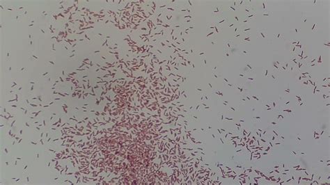 Gram Negative Rods Bacilli Of Pseudomonas Aeruginosa Microscopy