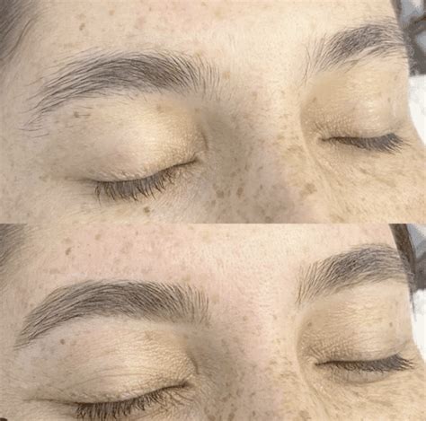 The Brow Fixx | How To Avoid Breakouts After Eyebrow Waxing