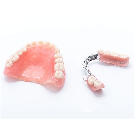 Partial Dentures For Back Teeth Fort Lauderdale FL Smiles By Julia