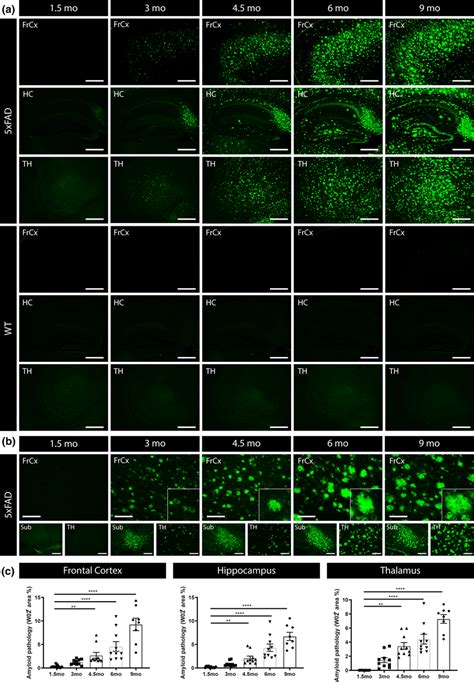 Progressive Amyloid Pathology In Xfad Mice A Representative Images Of