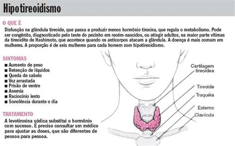 Hipotireoidismo Conhe A Os Sintomas Tratamentos E Preven O Da Doen A