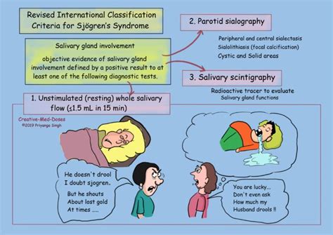 Sjogren Syndrome: Dry Eyes and Dry Mouth - Creative Med Doses