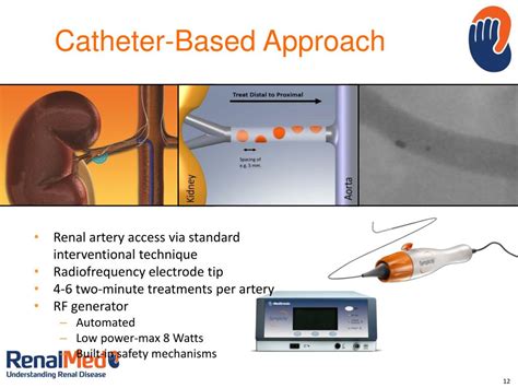 Ppt Renal Sympathetic Denervation Powerpoint Presentation Free Download Id2027307