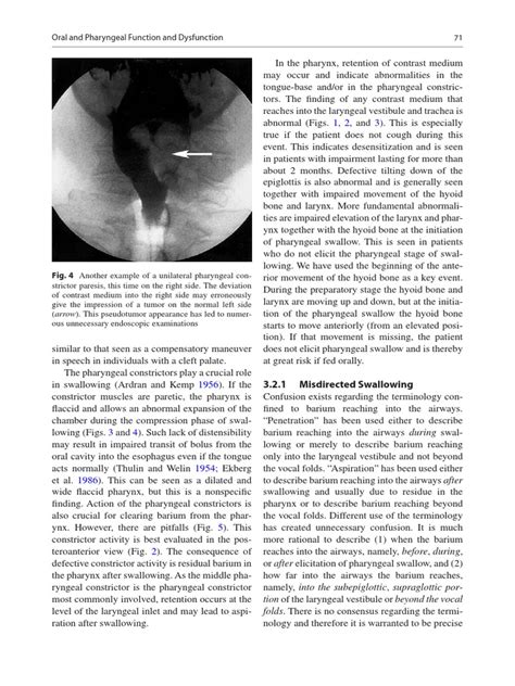 Dysphagia Diagnosis 1and Treatment (Olle Ekberg) (Z-lib.org) (1)-83-284 ...