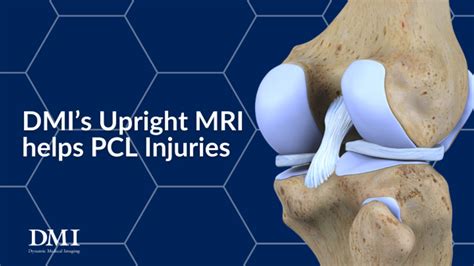 DMI’S UPRIGHT MRI HELPS PCL INJURIES