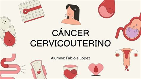 Resumen Sobre CÁncer Cervicouterinopptx Descarga Gratuita