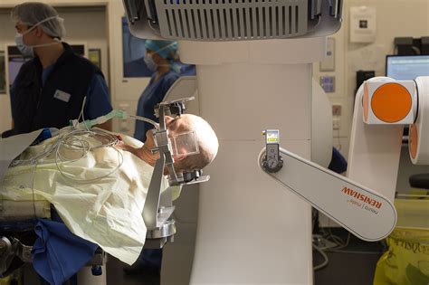 Deep Brain Stimulation For Parkinson S Disease Singhe