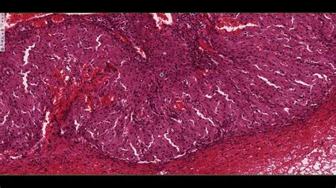 Corpus Luteum Histology Labeled