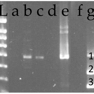 Agarose Gel Electrophoretic Analysis Of Dna Fragments Amplified From