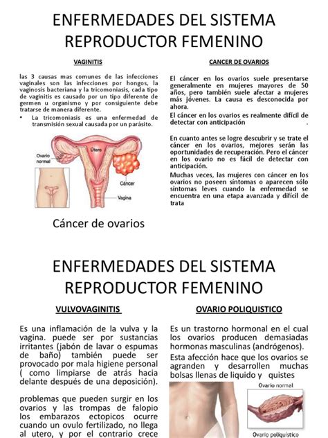 Enfermedades De Aparato Reproductor Femenino Pdf