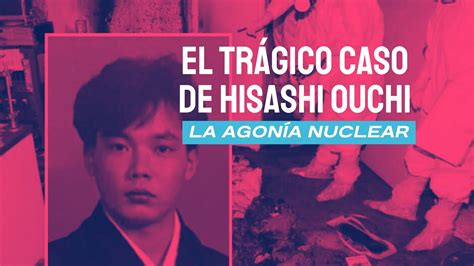 El trágico caso de Hisashi Ouchi La agonía nuclear YouTube