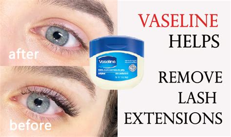 Learn How To Remove Eyelash Extensions With Vaseline Right Now Kwin Lashes