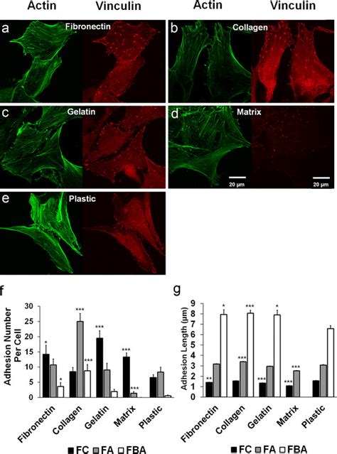 Expression Profile Of Vinculin Positive Focal Adhesions In Human Af