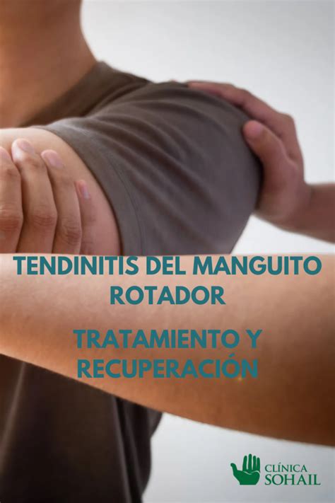 Tendinitis Del Manguito Rotador Tratamiento Y Recuperaci N Cl Nica