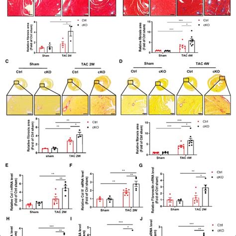 Deficiency Of Bmal In Cardiomyocytes Accelerates Tac Induced Cardiac