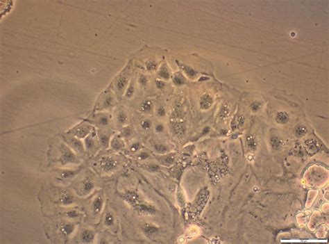 177 questions with answers in CACO 2 CELLS | Science topic 