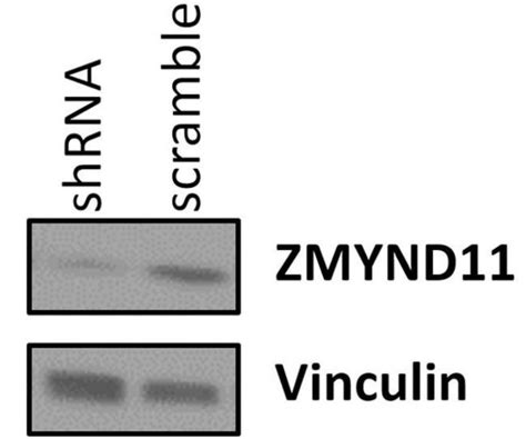 Zmynd11 Polyclonal Antibody Pa5 40960