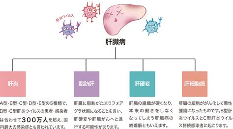 種類と症状・原因｜肝臓病について｜高知県肝疾患診療連携拠点病院等連絡協議会｜国立大学法人 高知大学医学部附属病院