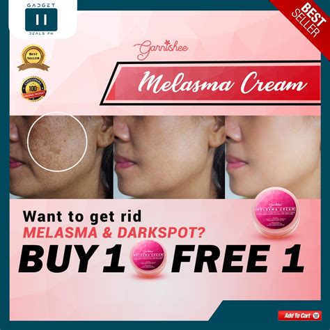 ℗buy 1 Get 1 Garnishee Melasma Cream 100 Effective Melasma Pekas