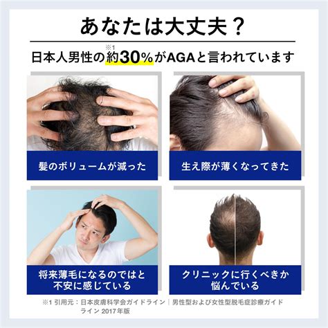 【楽天市場】aga 男性型脱毛症 による 抜け毛 ・ 薄毛 リスク 検査キット【 毛髪ホルモン量測定キット 】ジヒドロテストステロン