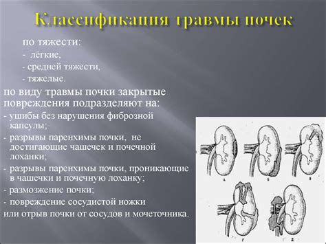 Травма почек и мочевого пузыря у детей - презентация онлайн
