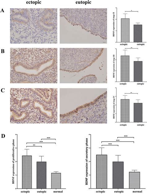 Immunohistochemical Staining Of Bdnf Immunohistochemical