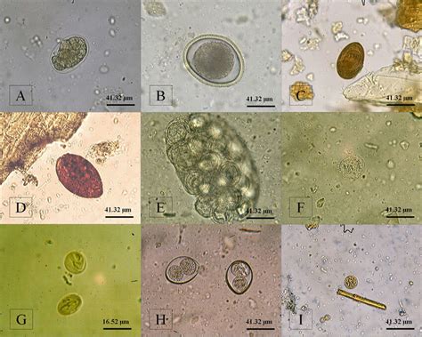 Parasitic Forms Eggs Cysts And Oocysts Observed In Download Scientific Diagram