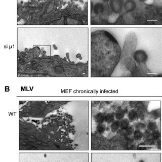 Mlv And Hiv Gag Interact With The Ap Complex In Vitro And In Vivo