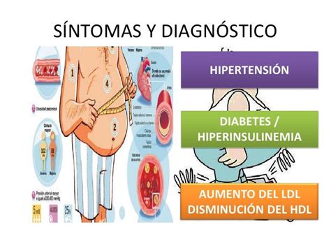 Sindrome MetabÓlico